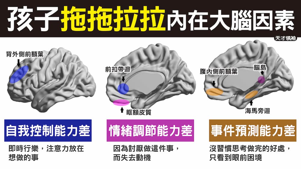 拖拖拉拉內在大腦因素